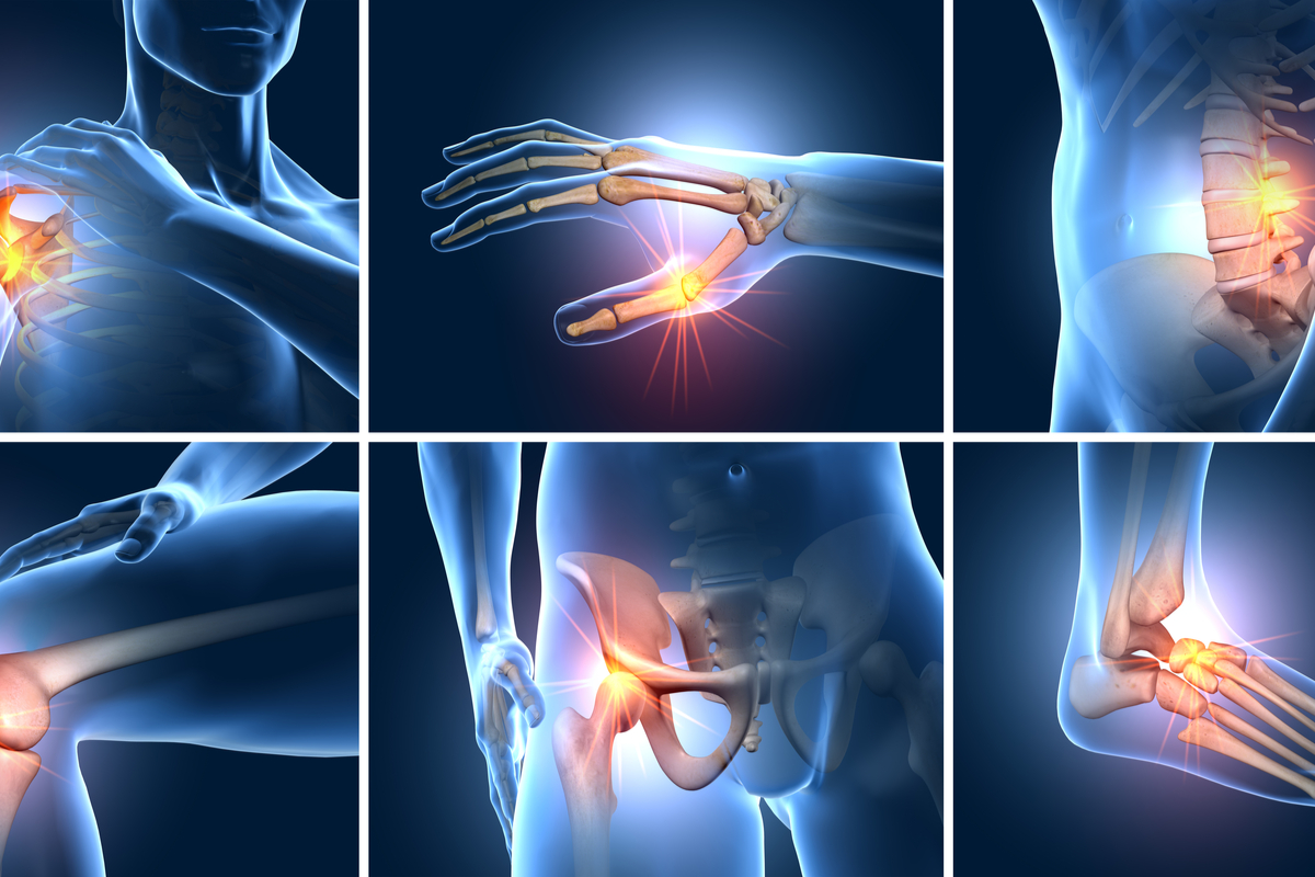 septic-arthritis-of-the-hand-from-etiopathogenesis-to-surgical-treatment